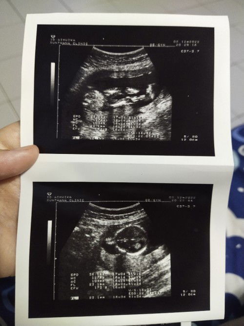 ทีม พฤษภาคม ท้อง4 จ้า ♥️