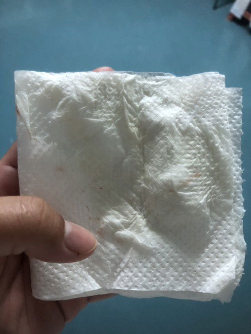 มีเลือดออกฝอยๆ