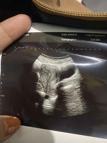 tentang kehamilan