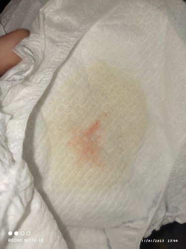 Pipis pertama bayi baru lahir
Apakah wajar warnanya seperti ini?