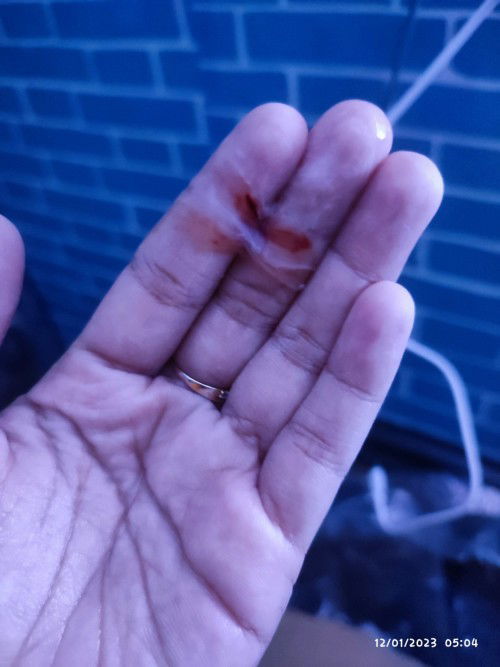 Keluar darah dan lendir usia 39 minggu 6 hari