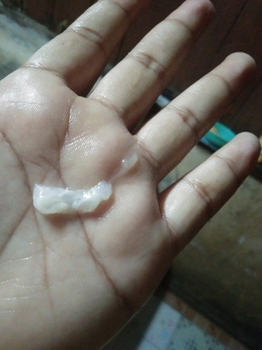 แบบนี้เรียกมูกใส่ไหมค่ะควรไปหาหมอไหม??