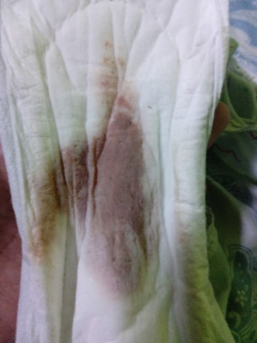 Hamil 6W Flek coklat selama 3 hari