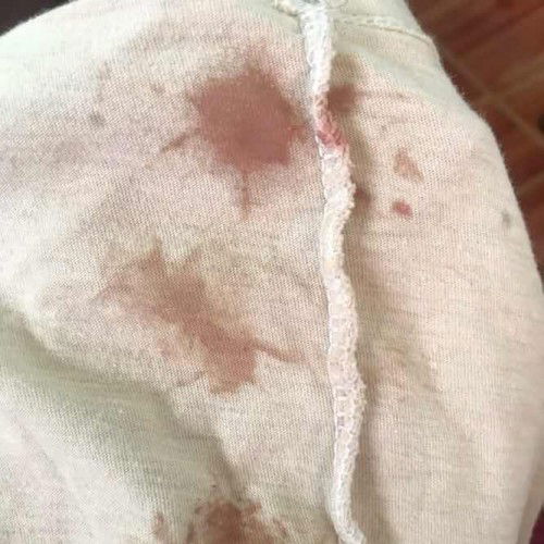 ปวดท้องไปหาหมอ