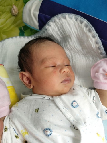 Bé em 16 ngày nổi mẩn vậy là bị sao bôi gì cho hết các m nhìn xót con quá