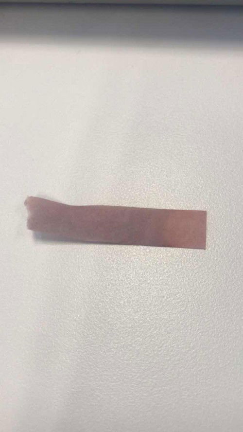 Apakah ini ketuban rembes