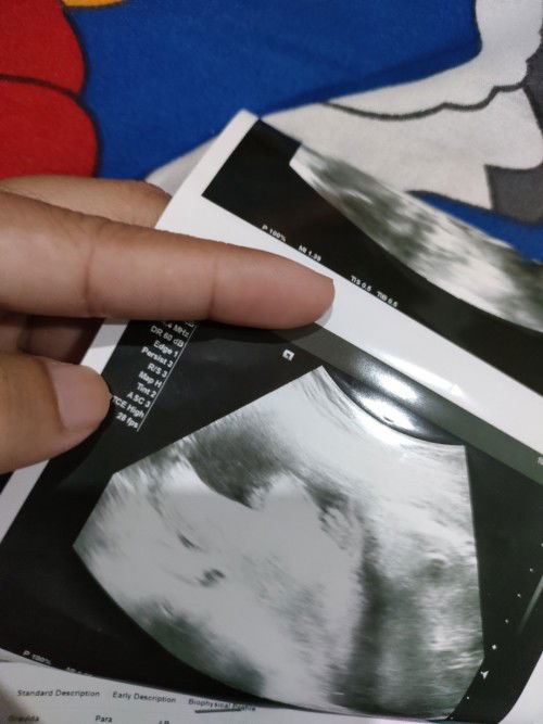 เพศอะไรค่ะแม่ๆ ดูไม่ออกเลย