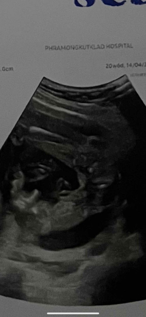 แม่ๆช่วยดูหน่อยค่า