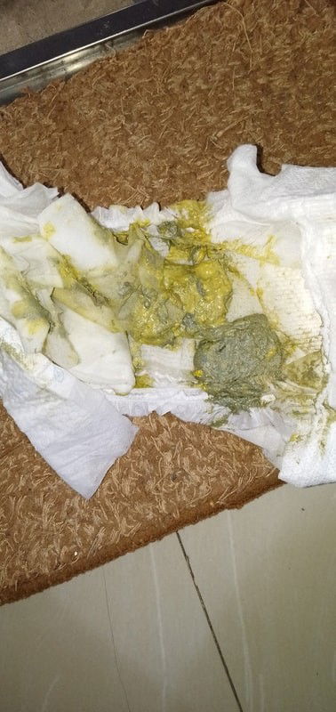 Yellowish Gray na poop ni baby