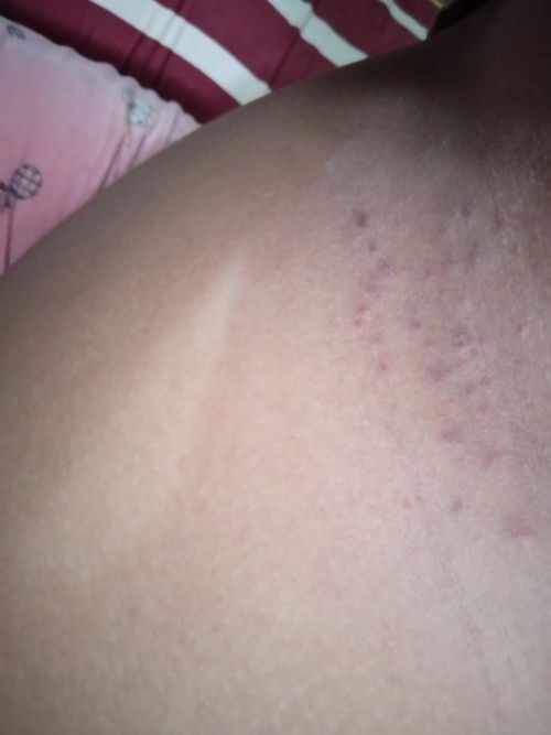 Bantu jawab dong bun