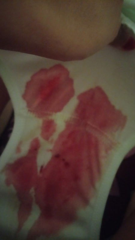 Plasenta masih dibawah