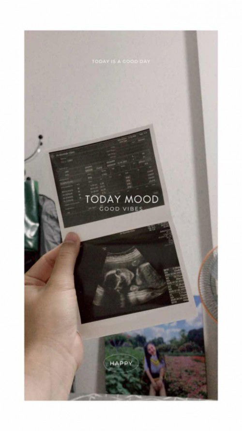 รู้ตัวว่าท้องตอน 22วีคแล้ว👶🏻