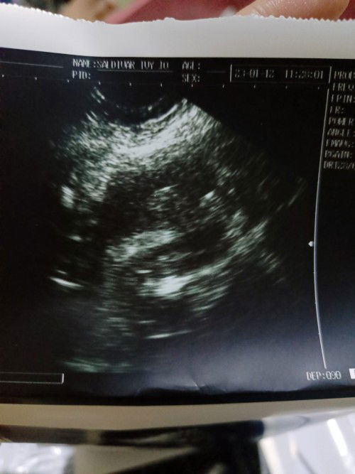 Panu nalaman yung Gender ?