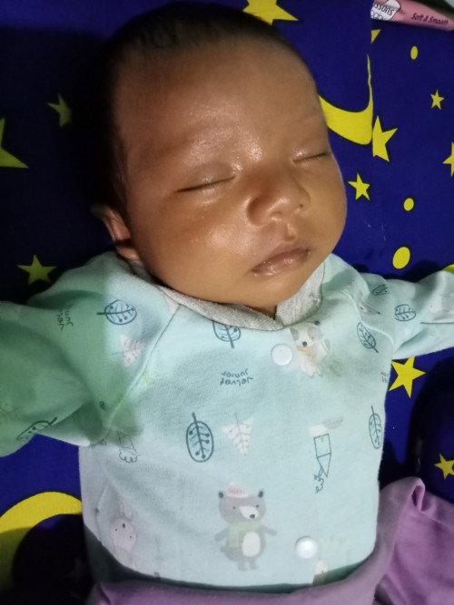 Bayi 1 bulan masih kuning