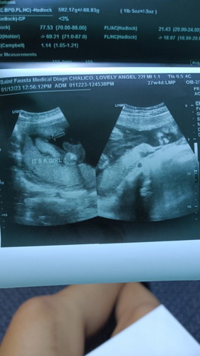 Hello Po mga mommy girl Po ba ung sa ultrasound ko tanong lang Po para sure pang 2nd baby ko Po ito.