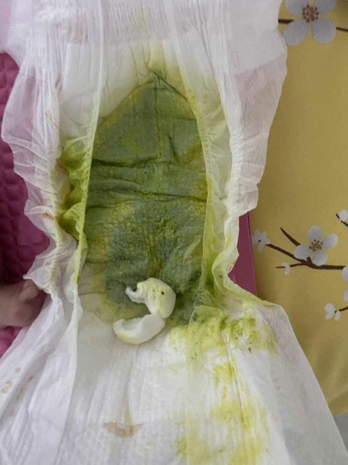 Bab bayi 1 bulan berwarna hijau