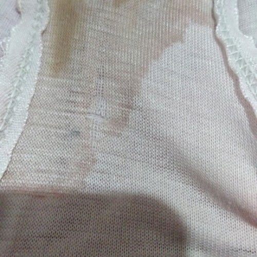 Keluar cairan coklat