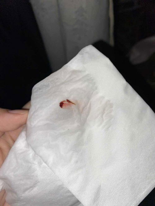 Hamil 8w, konstipasi