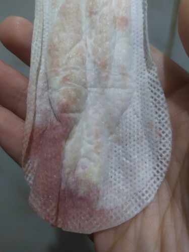 DISCLAIMER po sa pic hi mommys pink spotting po ba
to ?January 6 po kase last making 7 po ovulation