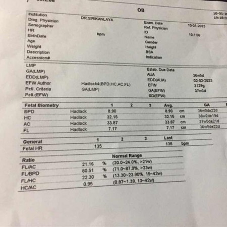 ขออนุญาตถามแม่ ๆ