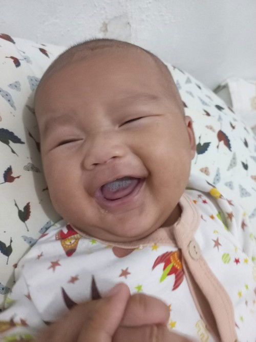 Lidah putih pada bayi