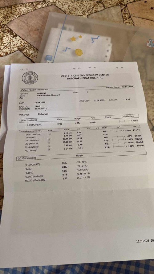 เราดูไม่เป็นค่ะว่าในใบกี่วีกแล้ว