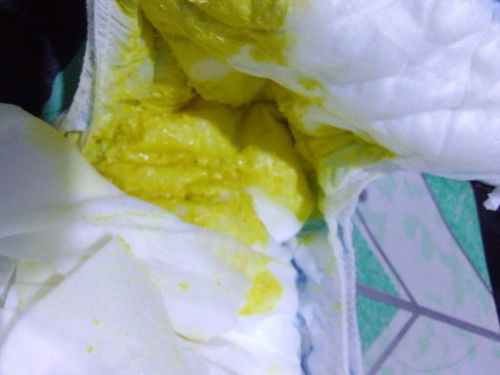 Kulay dilw po at basa po  may ksamang mga puti na parang gatas 8months napo siya wala padin po ngipn