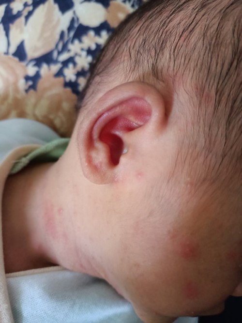 Bayi 2minggu