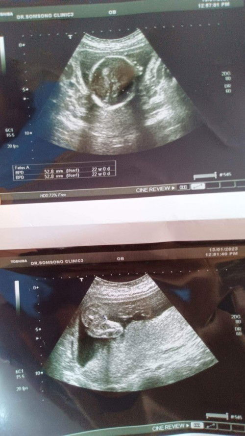 เพื่อนท้อง22สัปดาห์