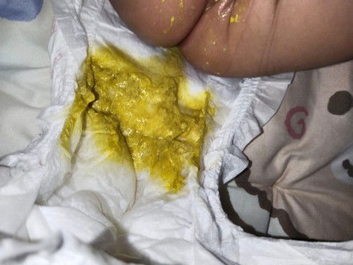 ขอความรู้ค่ะ