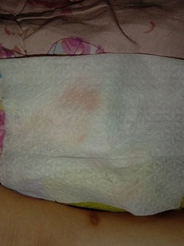 Light pink discharge