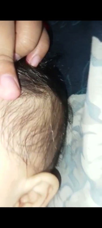 Bayi kok bisa beruban kenapa ya?