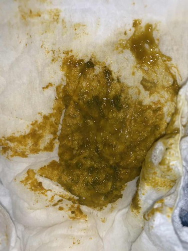 สอบถามหน่อยคะ😄
น้องได้29วันอึแบบนี้ปกติไหมคะแม่ๆ