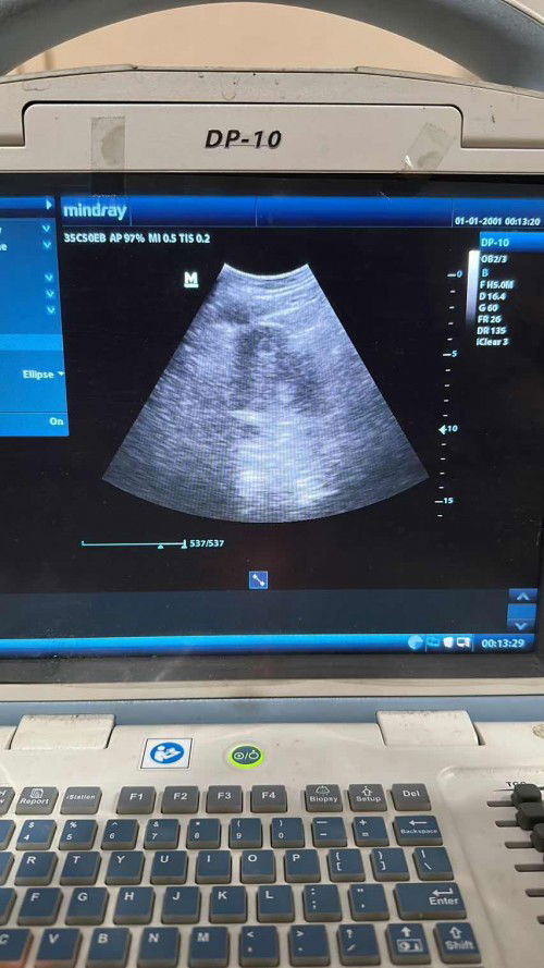 Hasil usg 6 week aku