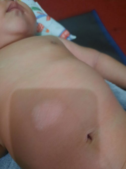 Semoga ada yg pengalaman sama