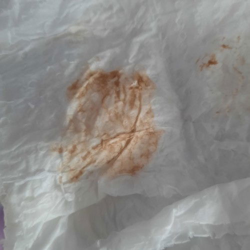 32weeks. Ada discharge sikit pagi ni. Ada sesiapa tahu tak normal ke ni?