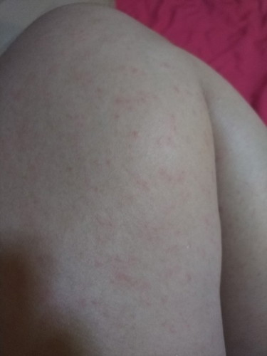 ผืนขึ้นทั้งตัว