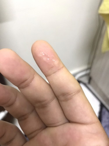37w2d keluar lendir
