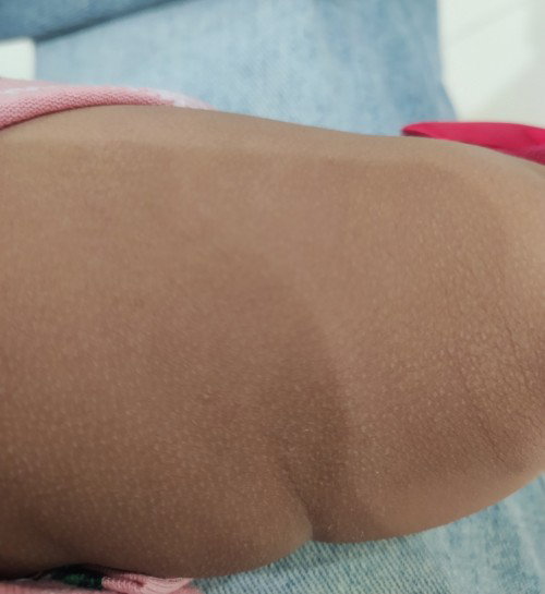 Butlig butlig na magaspang