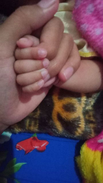 Hb setelah nifas, selepas itu saya menstruasi apakah itu hal yang normal?
Fyi saya belum kb