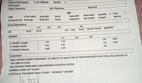 Sana matulungan nyo po ako if Myron Po mkaexperience nyan dito..
