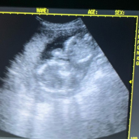 Boy or girl?