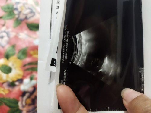 Apakah hamil bo lagi?