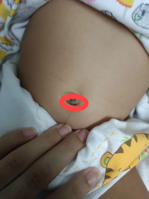 แม่ๆๆค่ะ ขอคำแนะนำค่ะ