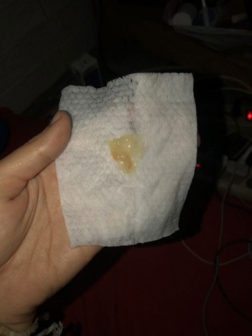 สอบถามแม่ๆหน่อยค่ะ