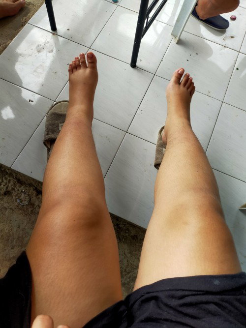 Beri Beri after manganak