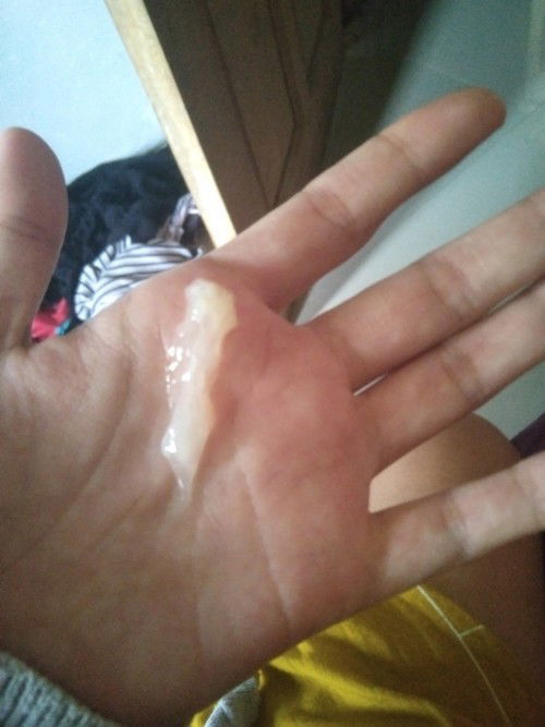 Bun saya dua har akhir ini keluar lendir gini trus juga seperti air lendir jg ini mksd a gmn ya Bun.