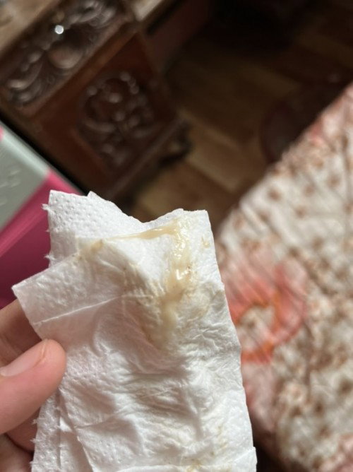 Mucus plug