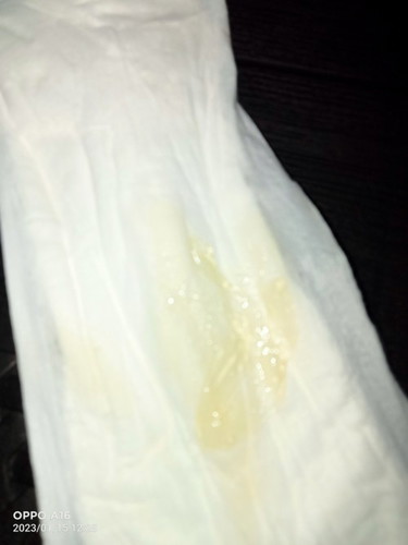 Mucus plug ?