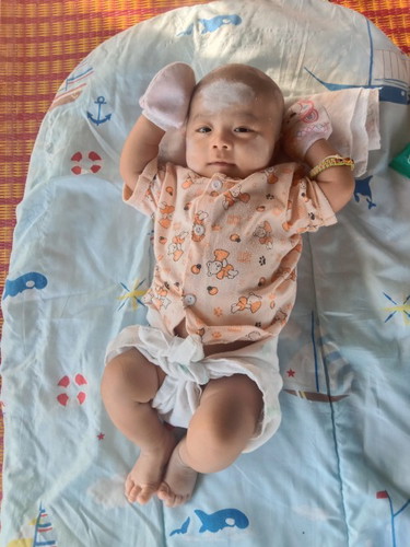 ลูก 1 เดือน 20 วันตัวเล็กมั้ย